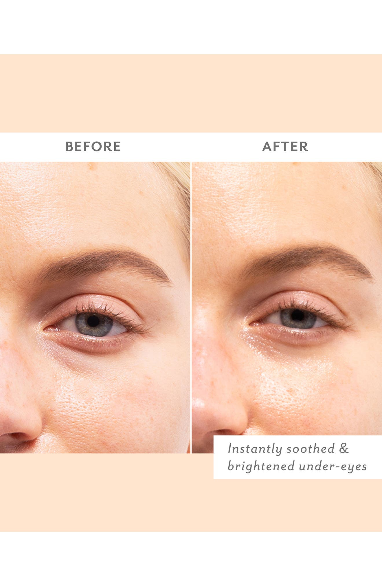 Patchology 5-Pack Skin Remedy Soothing Eye Gels