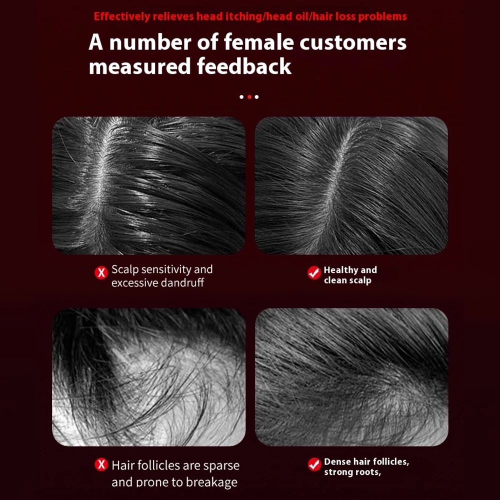 Electric Hair Regrowth Brush with Infrared Light Machine Acupoint Scalp Massage Anti-Hair Loss Exercise Hair Scrubber Combs NMSZ506250