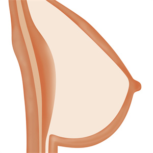 Sex Doll Solid Breasts