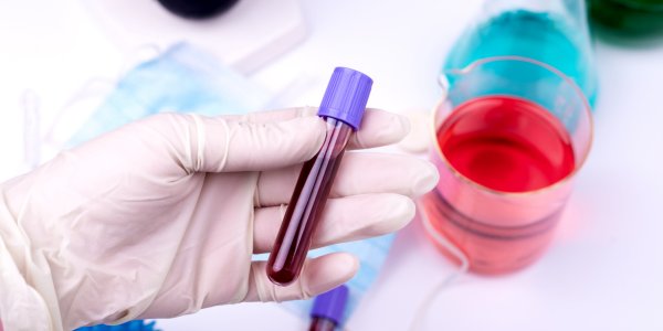 Get Regular Screenings After Chlamydia Treatment