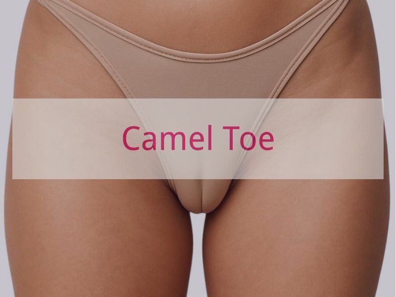 Camel Toe