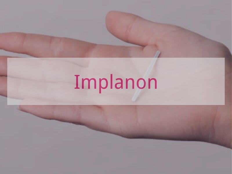 Implanon