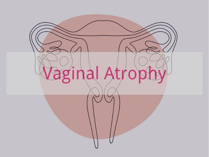 Vaginal Atrophy