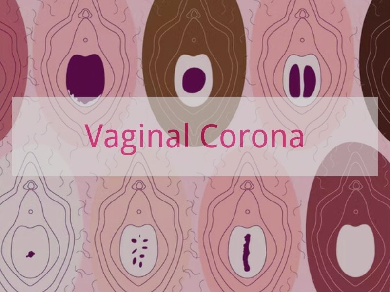 Vaginal Corona