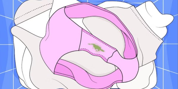 What is Vaginal Discharge