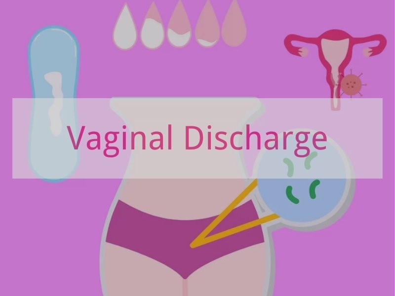 Vaginal Discharge