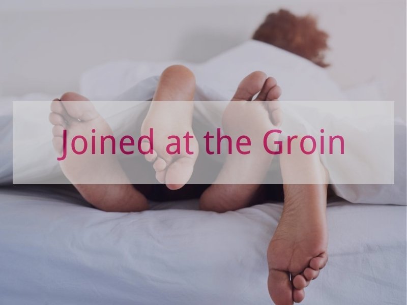 Joined at the Groin