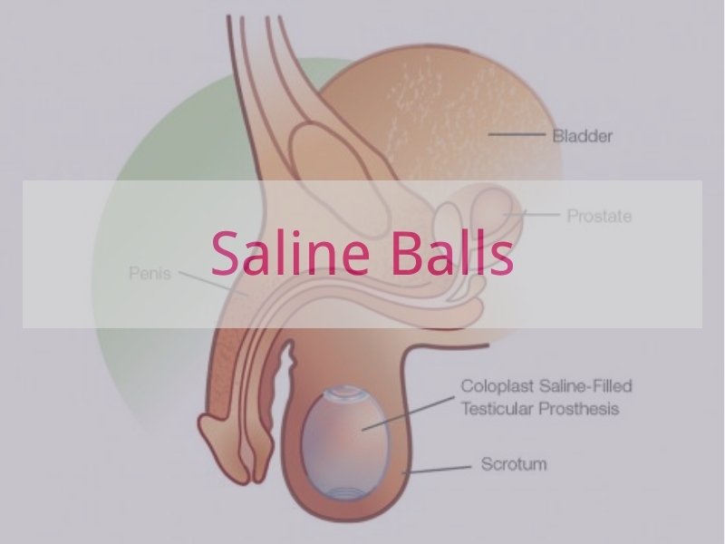 Saline Balls