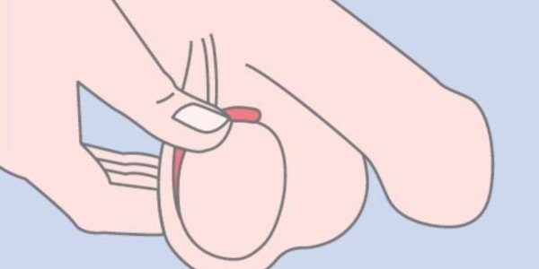 What is Testicular Exam