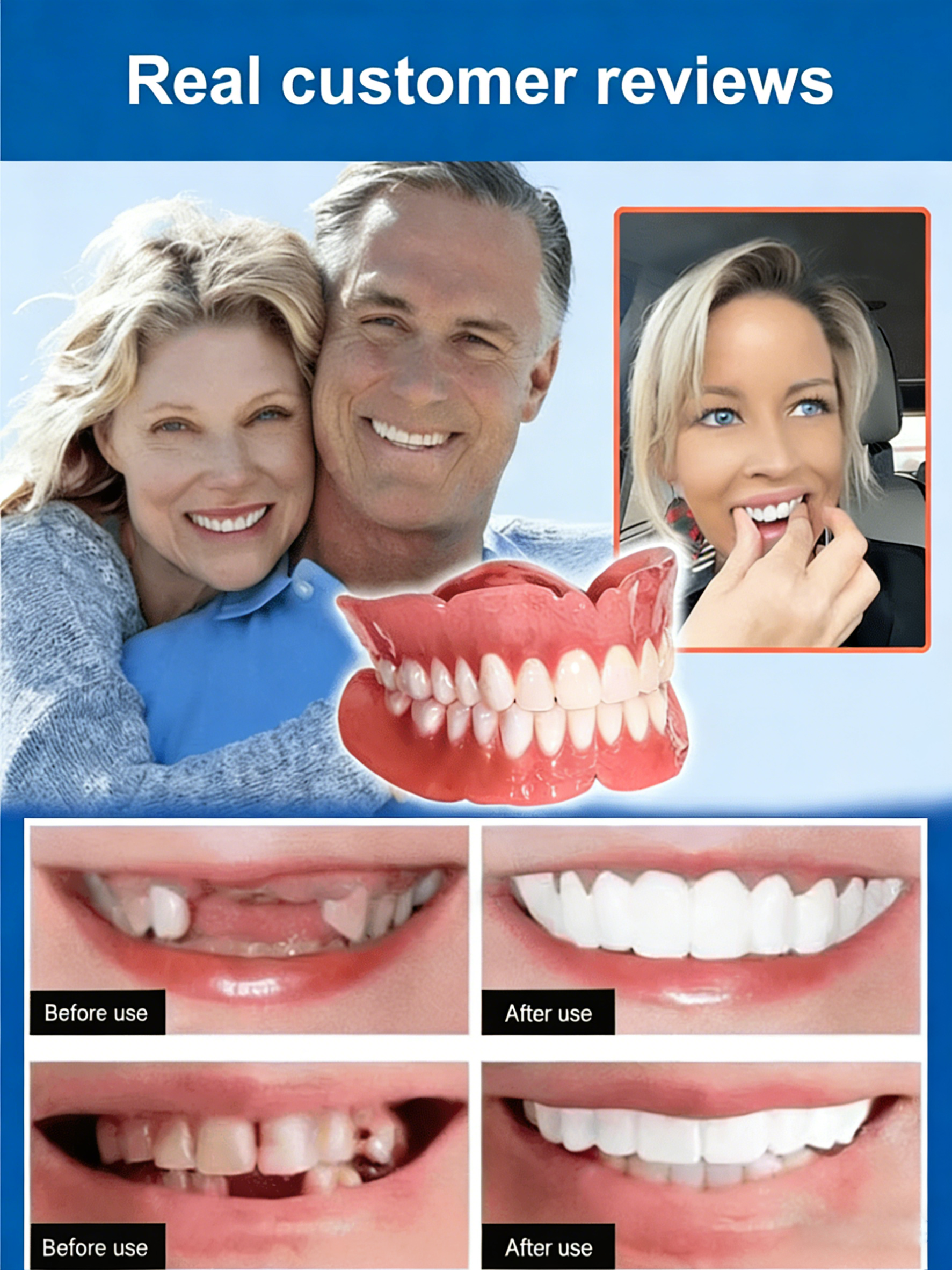 Perfect Dental Cover – Ideal Smile, Easy to Use, Popular in the United States