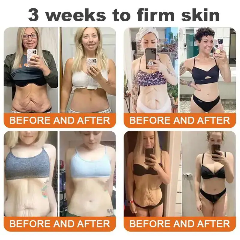 FlysmusrmBotox Bee Venom FirmingSerum StickLAST DAY 7O%OFF