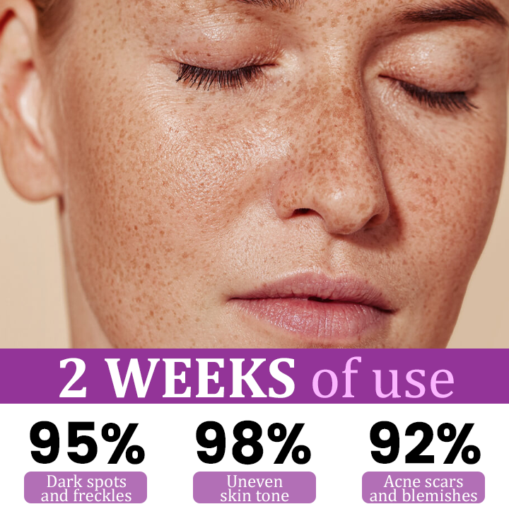 ⚡ New Year Flash Deals! 50% OFF - Intensive Hyperpigmentation Treatment Serum