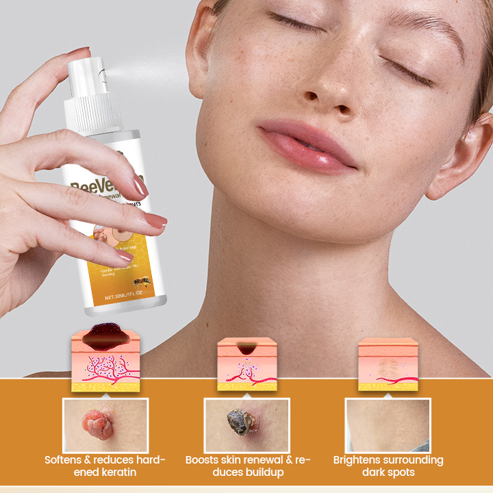 Timilk® BeeVenom Wart Renewal Spray