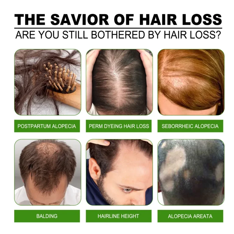 Neo Hair Lotion Growth Serum Oil