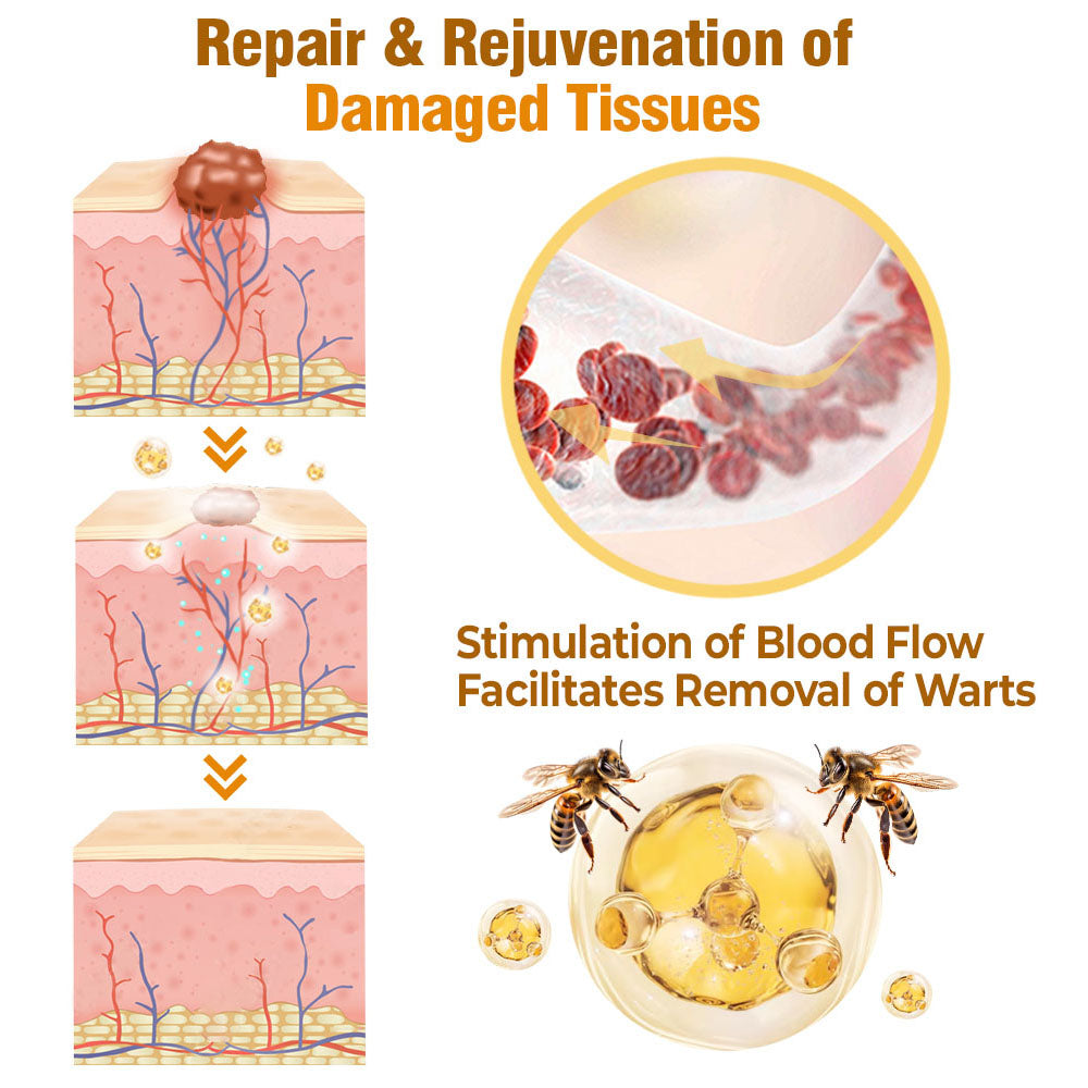 🐝 flysmus® Bee Venom Comprehensive Cream 🇬🇧 Made in UK