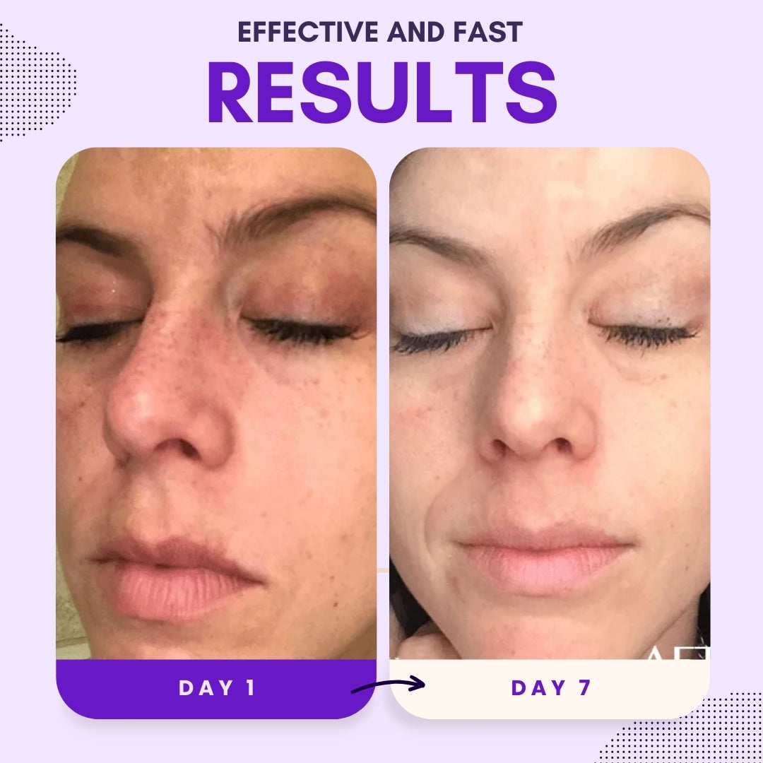 Limited Stock!!⚡LOVILDS® Thiamidol 630 Serum