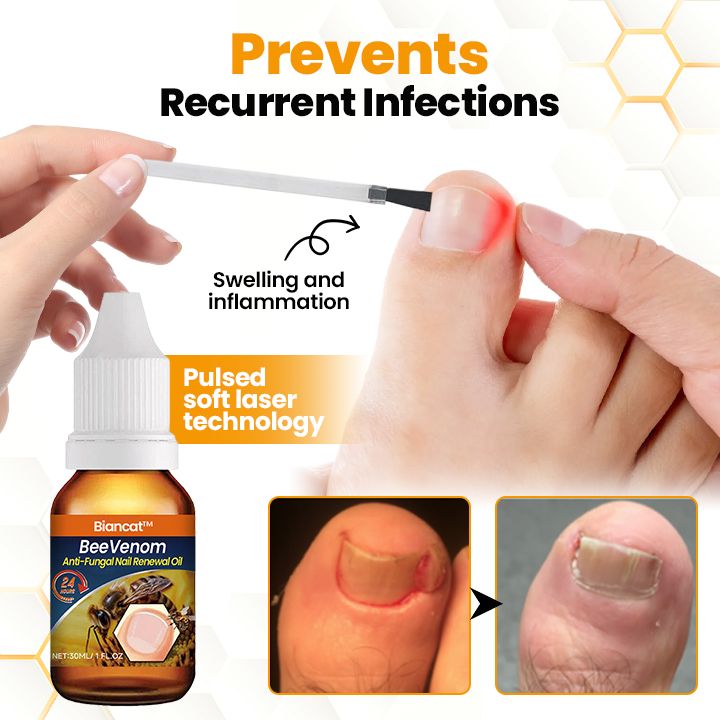Antifungal Nail Revitalizing Oil with Bee Venom