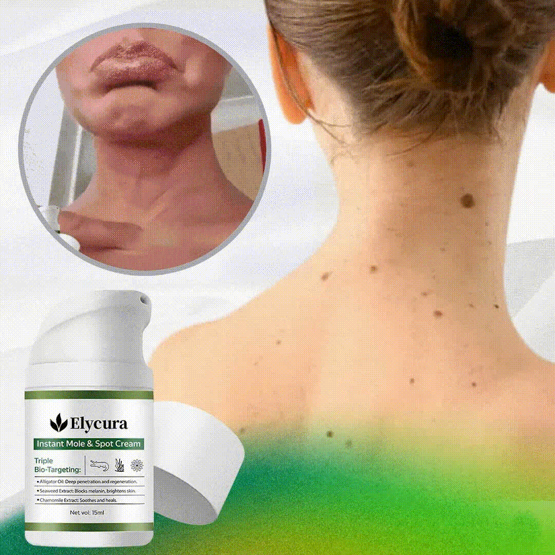 Elycura™ NatureErase: Erase Unwanted Marks in 7 Days Without Surgery, Pain, or $650 Doctor Bills